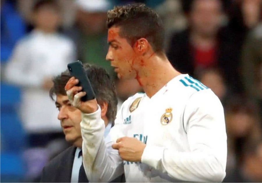Ronaldo, sângele şi selfie-ul